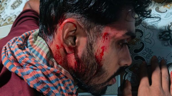 বিয়ে বাড়ির গায়ে হলুদে এলোপাতাড়ি গুলি ক্যামরাম্যানসহ গুলিবিদ্ধ-৪